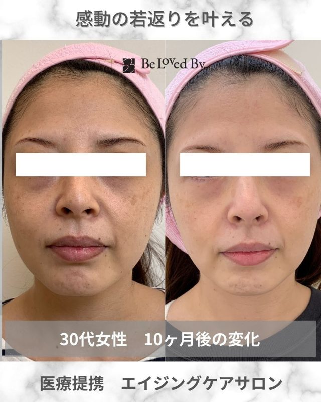 公式】Be Loved By. 大阪 茨木の医療提携エステサロン