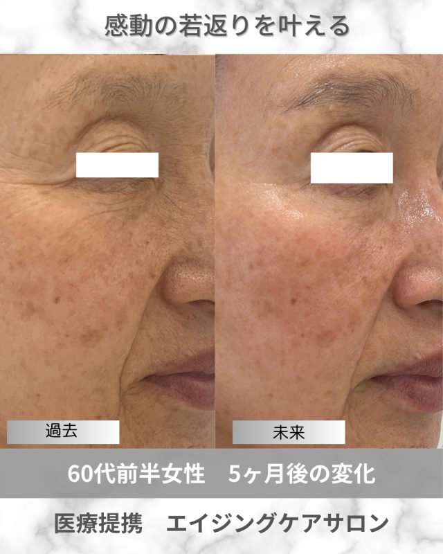 公式】Be Loved By. 大阪 茨木の医療提携エステサロン