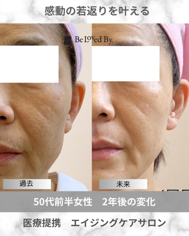 ⭐️新品未使用 ビーラブドバイ⭐️6種類 美容液 クリーム セット ⭐️新品未使用 ビーラブドバイ⭐️6種類 美容液 クリーム セット