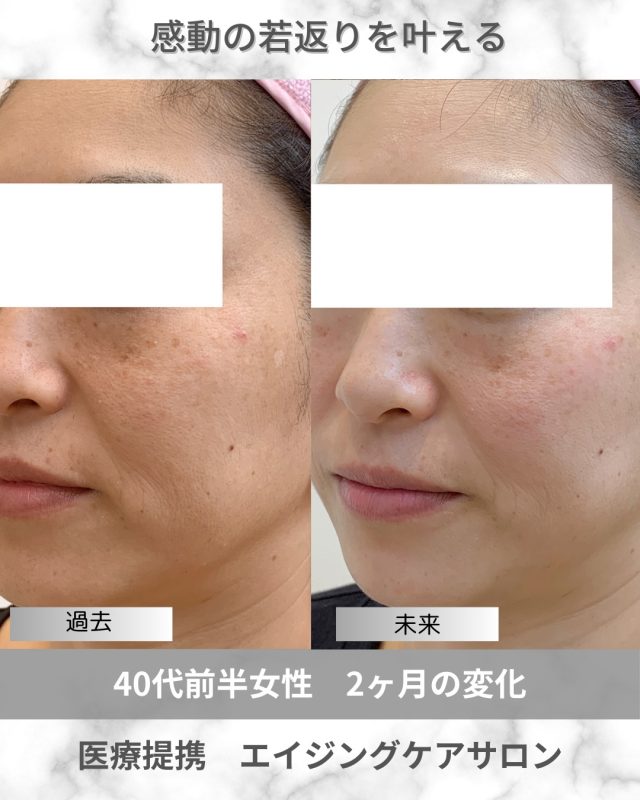 専用です☆ビーラブドバイ 公式】Be Loved By. 大阪 茨木の医療提携エステサロン