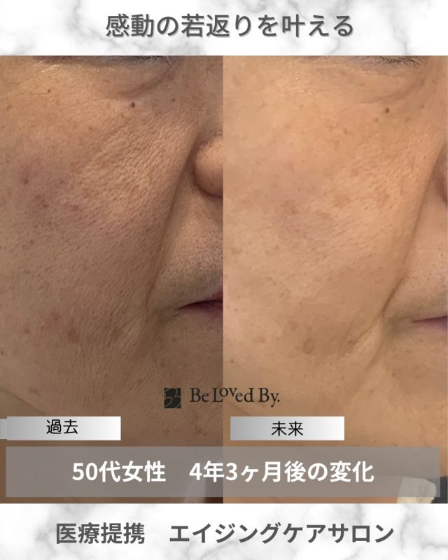 公式】Be Loved By. 大阪 茨木の医療提携エステサロン